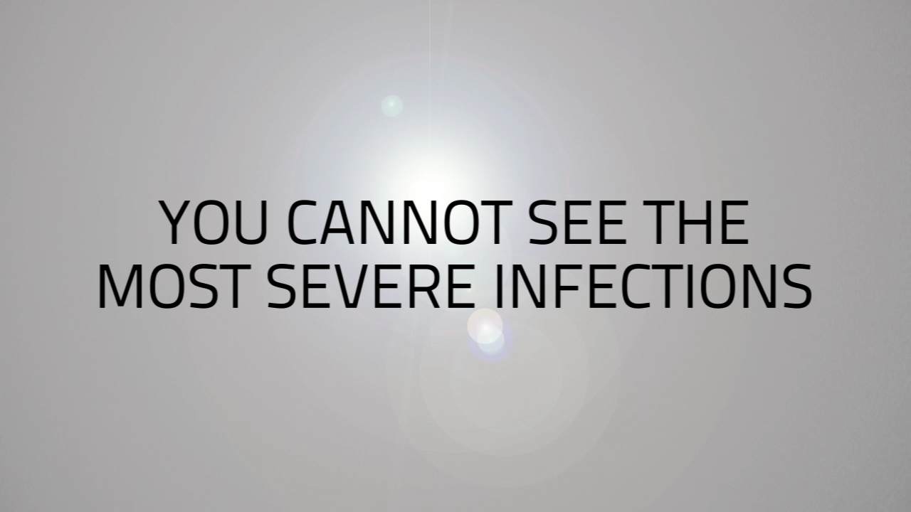 Infections